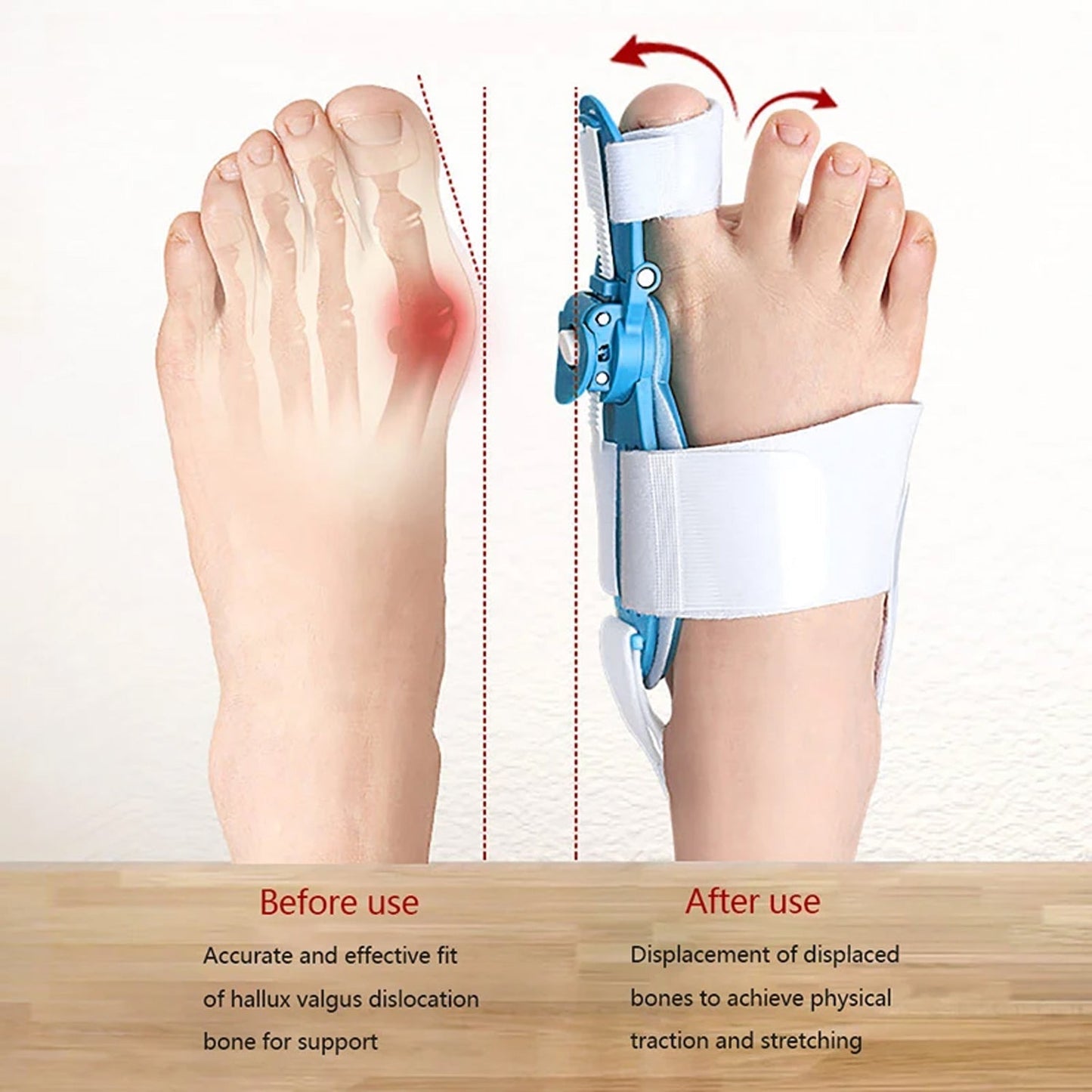 Adjustable Bunion Support Splint – Hallux Valgus Corrector for Men & Women Your Brand