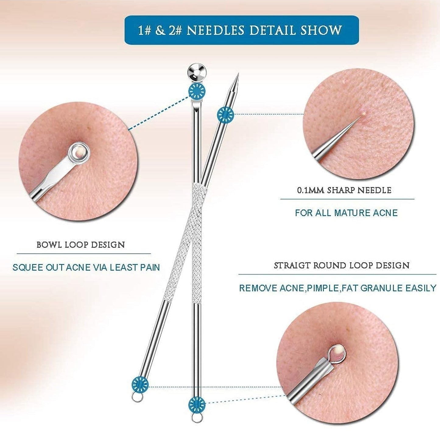 Blackhead Remover, 4-in-1 Stainless Steel Pimple Extractor Tool (1 Pc) Your Brand