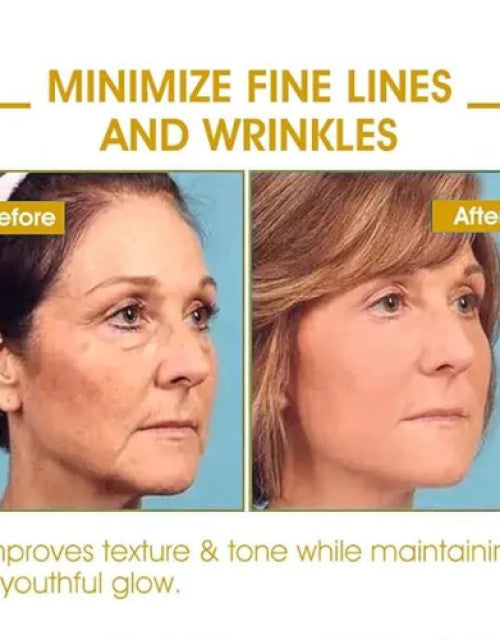 Before and after images showing minimized fine lines and wrinkles using bee venom vitiligo cream
