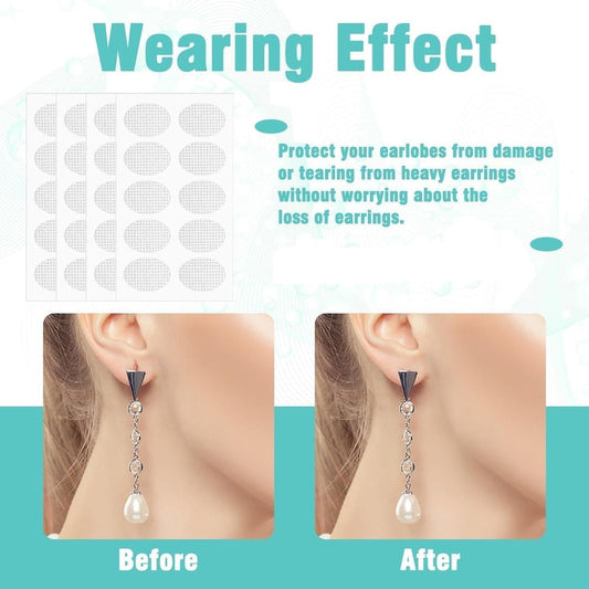 Earlobe support patches displayed near before and after images demonstrating earring protection