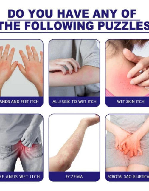 Signs of skin issues including hands and feet itch, allergic wet itch, wet skin itch, anus wet itch, eczema, and scrotal irritation eczema and fungal cream pack