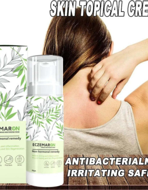 Eczema and fungal cream pack by The Gir Farmer shown with packaging and a person scratching irritated skin