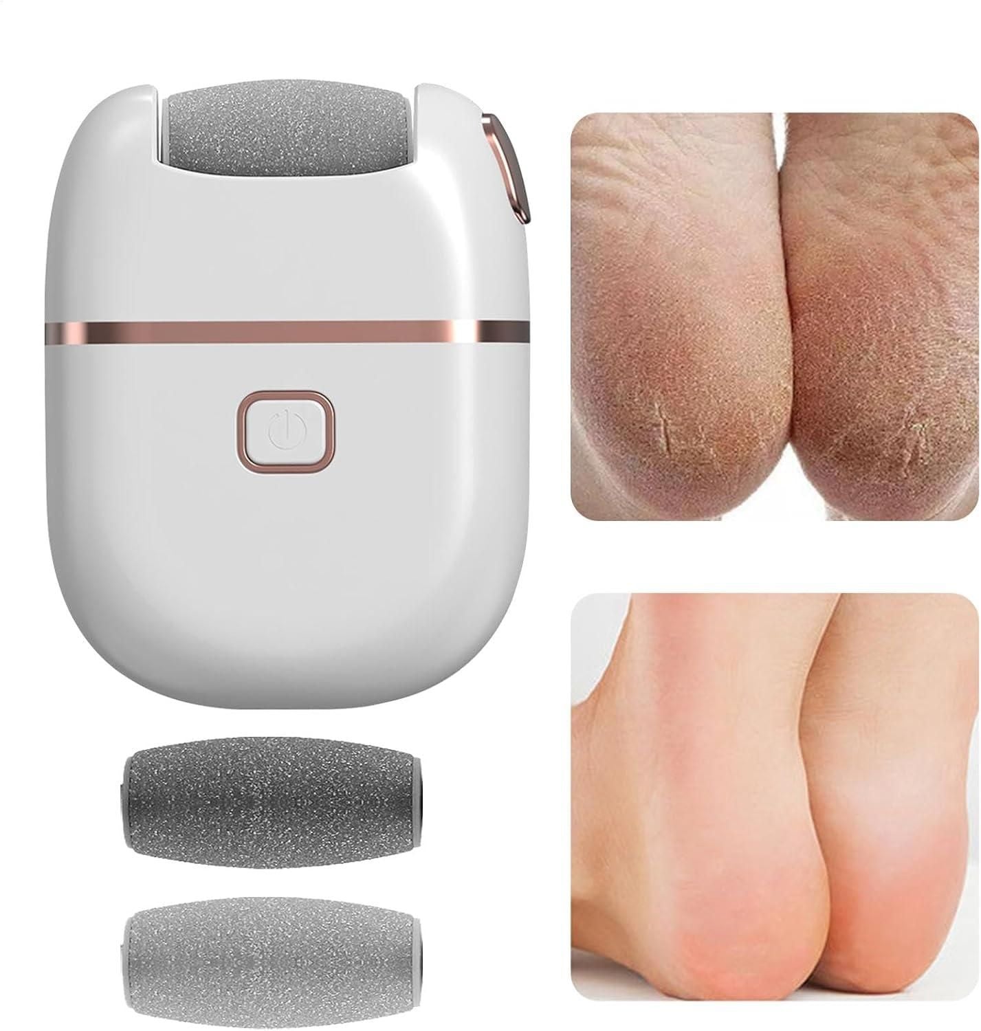 White electronic pedicure tool with two replacement rollers and before and after foot heel care results