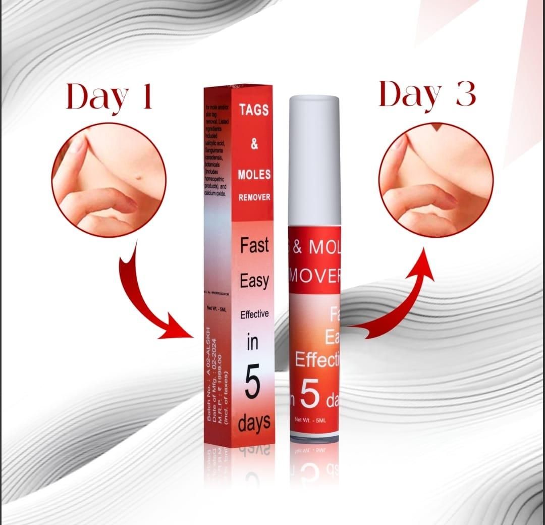 Fast acting tag and mole remover showing results on skin from day 1 to day 3 with product packaging
