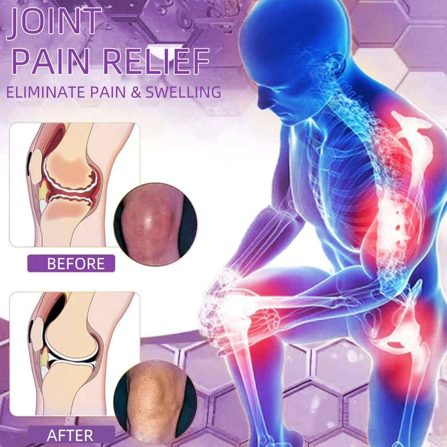 Joint Pain Relief Gel for Eliminating Pain and Swelling with Before and After Comparison