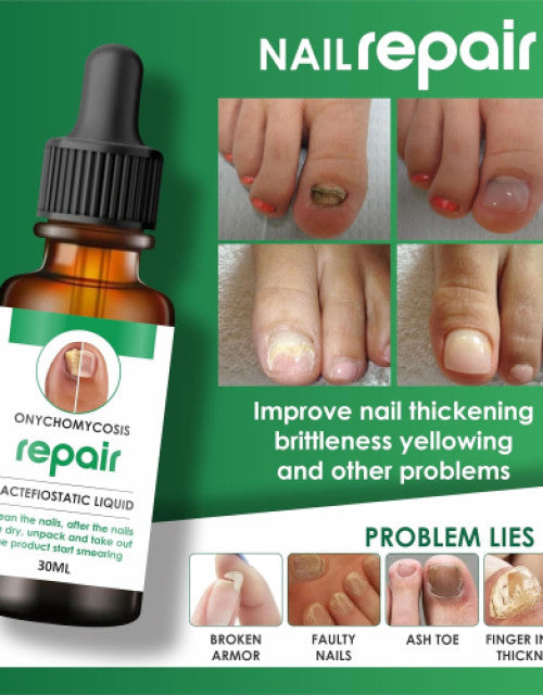 The Gir Farmer best nail repair treatment pack for improving nail thickening brittleness and yellowing
