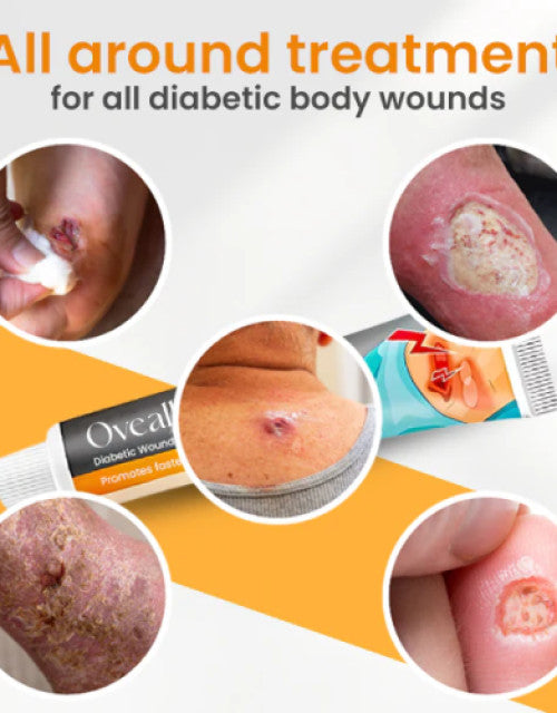 The Gir Farmer diabetic wound healing cream with images of diabetic body wounds showing treatment effects