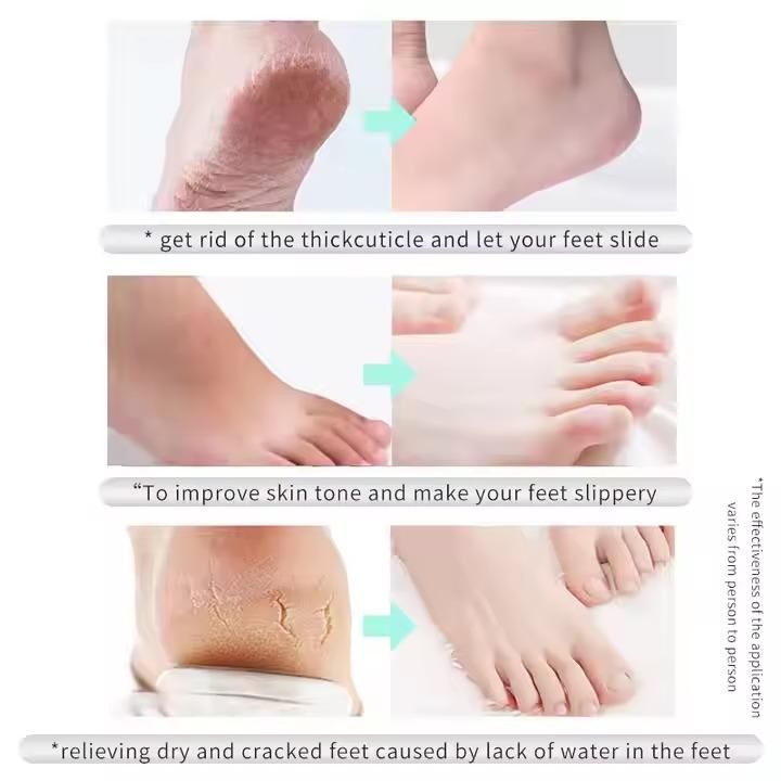Before and after results of using THE GIR FARMER goat milk foot mask showing smooth, hydrated feet and healed cracked heels