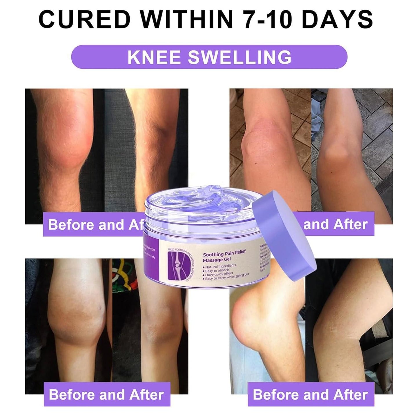 Soothing pain relief gel for knee swelling with before and after images showcasing effectiveness