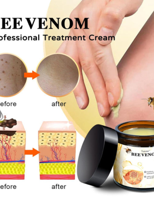 Bee venom cream for acne scars by The Gir Farmer showing before and after results and application on skin