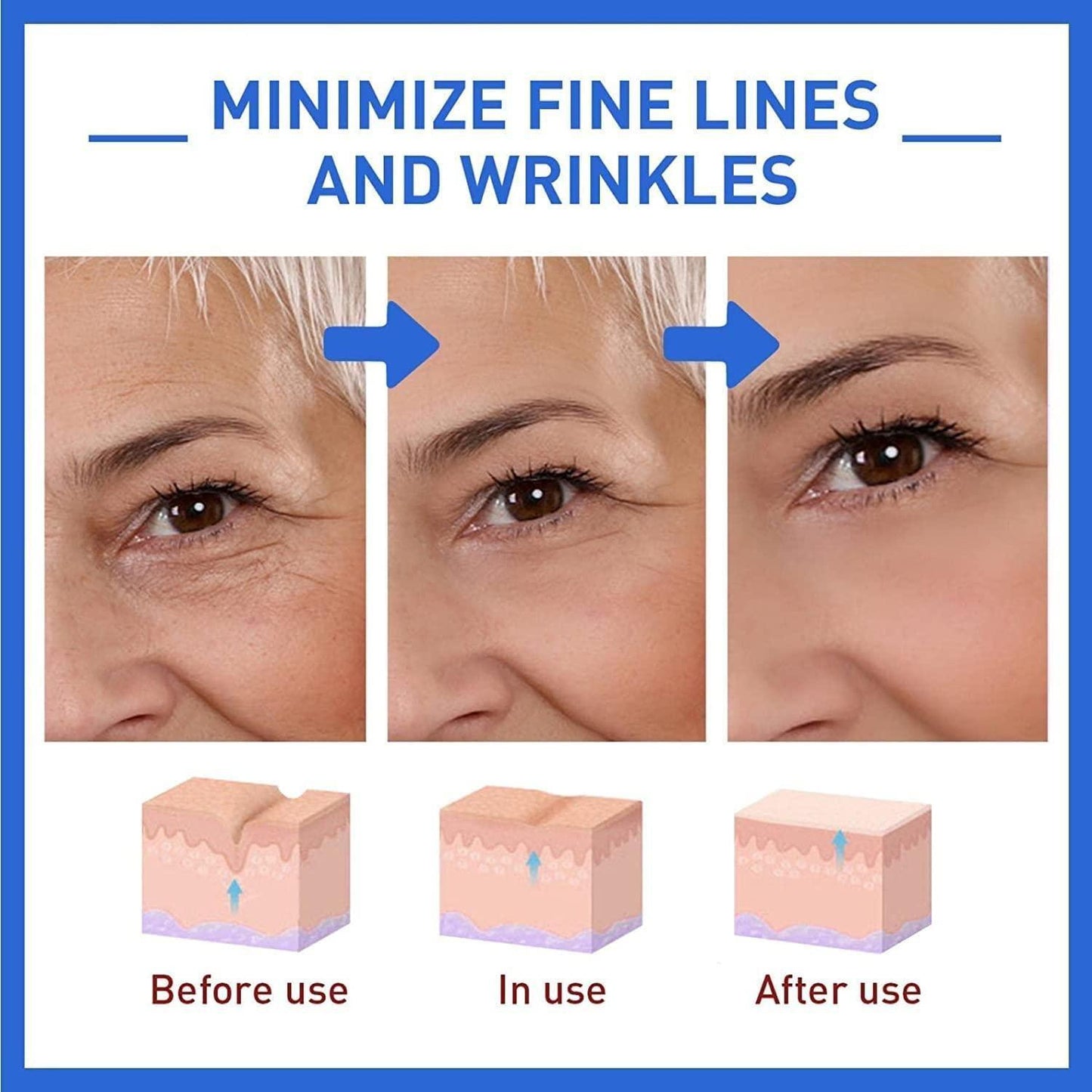 Botox anti-aging serum visual guide showing effects on fine lines and wrinkles before and after use
