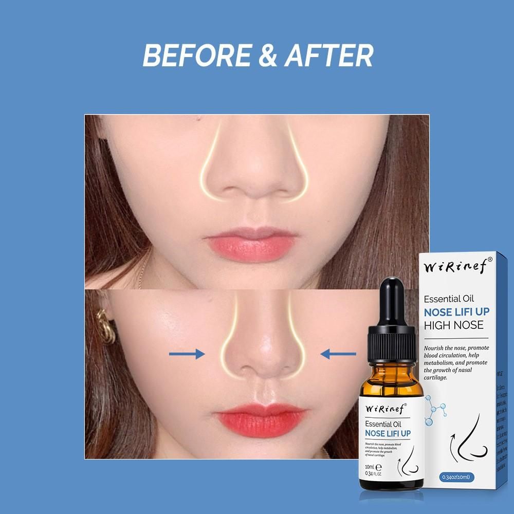 Before and after comparison of nose lifting oil with enhancing results for a refined nose shape
