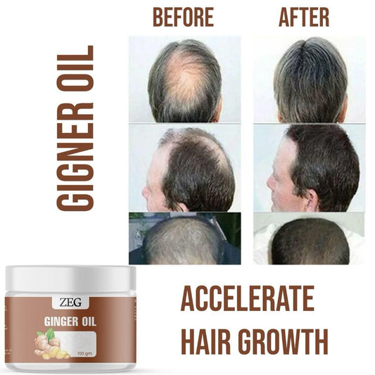 ZEG Ginger Oil for body massage in a jar, promoting healthy hair growth with before and after images
