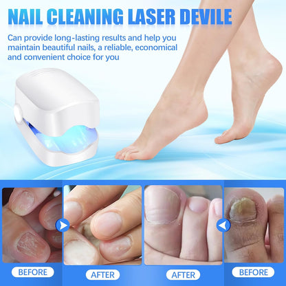 Rechargeable Nail Fungus Laser – Anti-Fungal Device for Toenails, Hands & Feet (Home Use) Your Brand