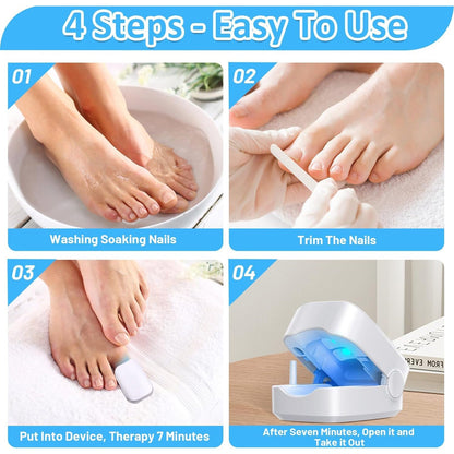 Rechargeable Nail Fungus Laser – Anti-Fungal Device for Toenails, Hands & Feet (Home Use) Your Brand