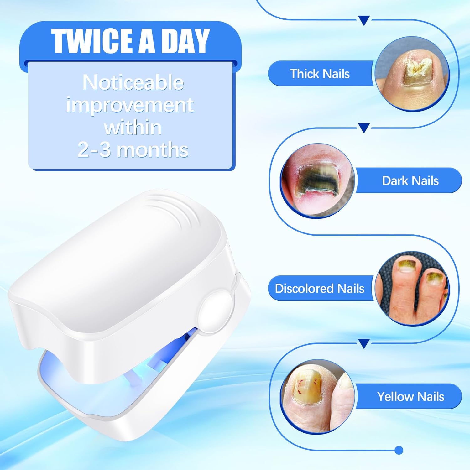 Rechargeable Nail Fungus Laser – Anti-Fungal Device for Toenails, Hands & Feet (Home Use) Your Brand