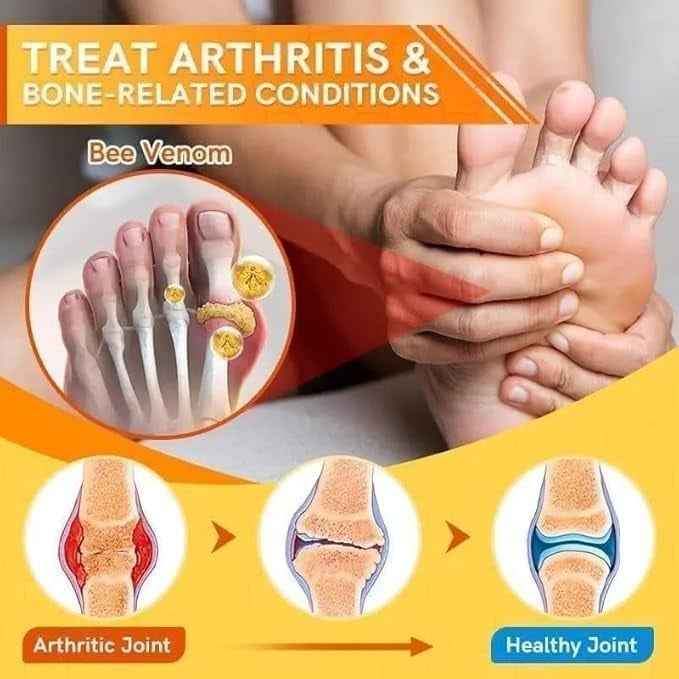 Natural Varicose Vein Relief Spray - Pack of 3