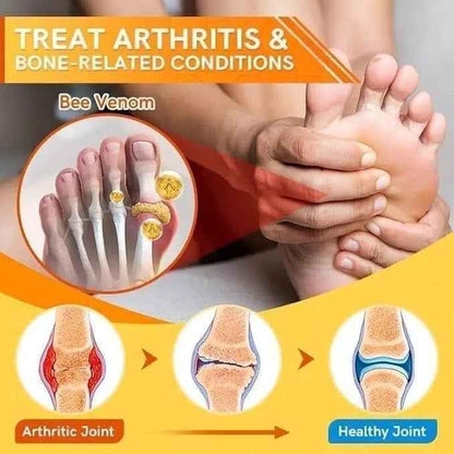Natural Varicose Vein Relief Spray - Pack of 3