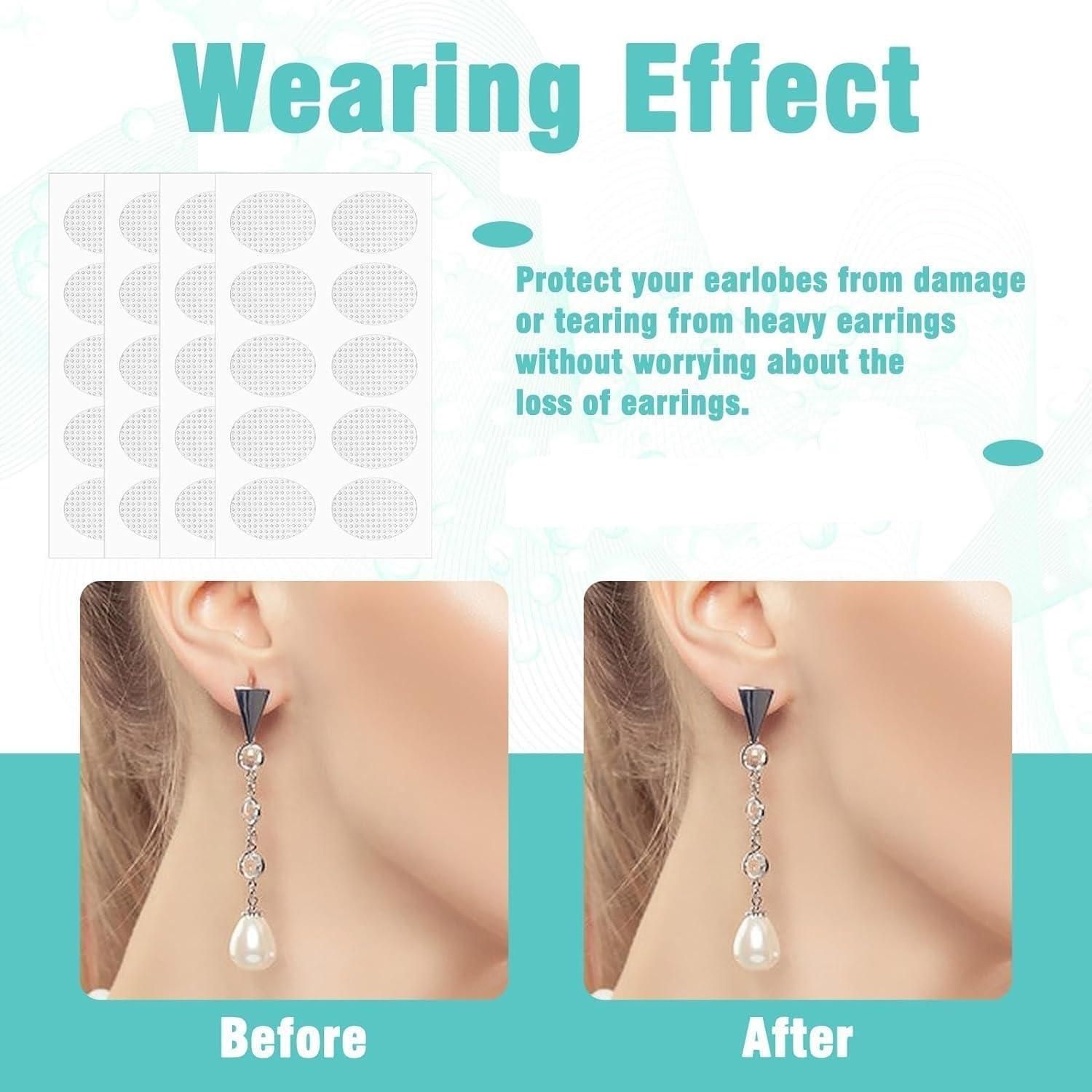 Earlobe support patches displayed near before and after images demonstrating earring protection