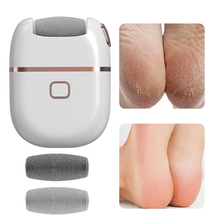 White electronic pedicure tool with two replacement rollers and before and after foot heel care results