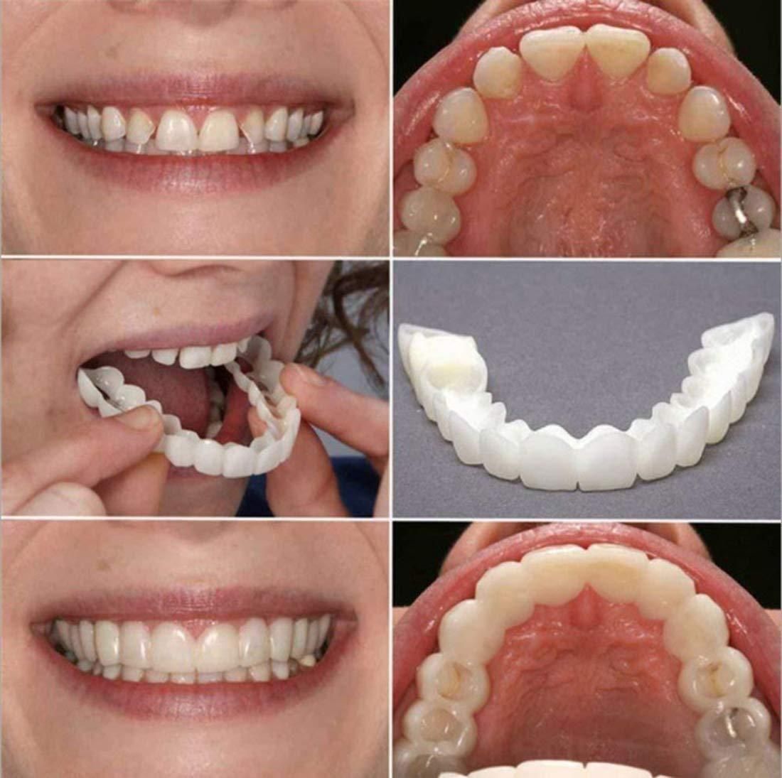 Flex cosmetic teeth veneers showcasing before and after results with easy application process