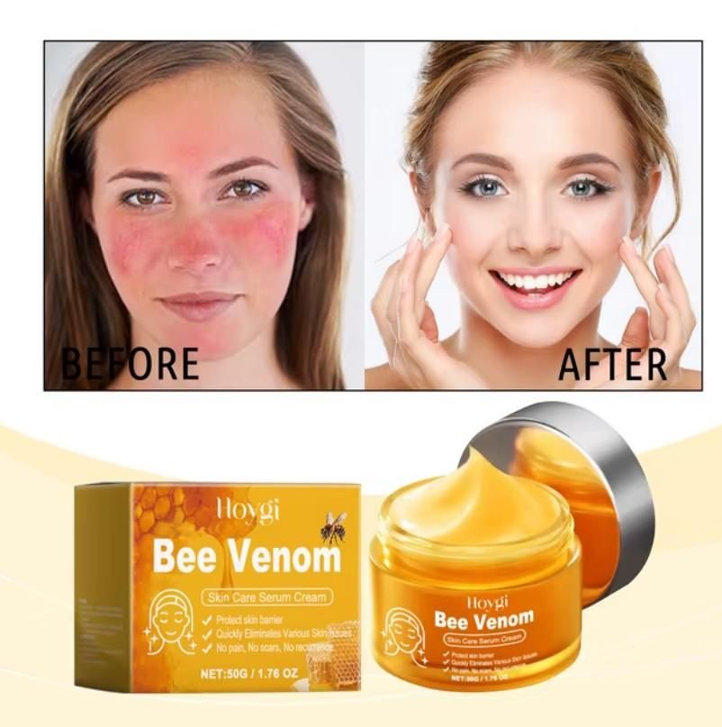 Before and after using bee venom skin cream showing improved skin tone and texture