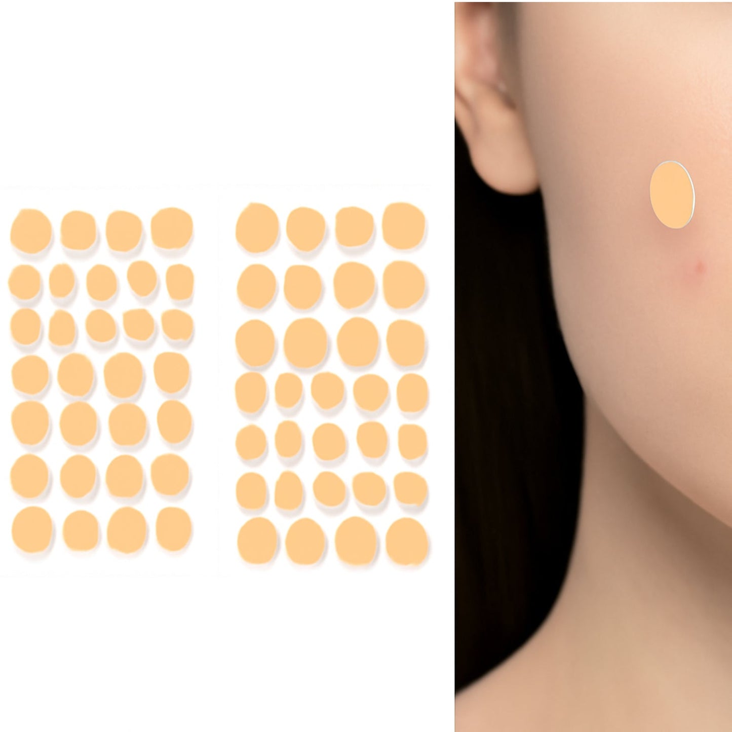 Natural acne spot treatment patches in a pack shown on a model's face for effective blemish care