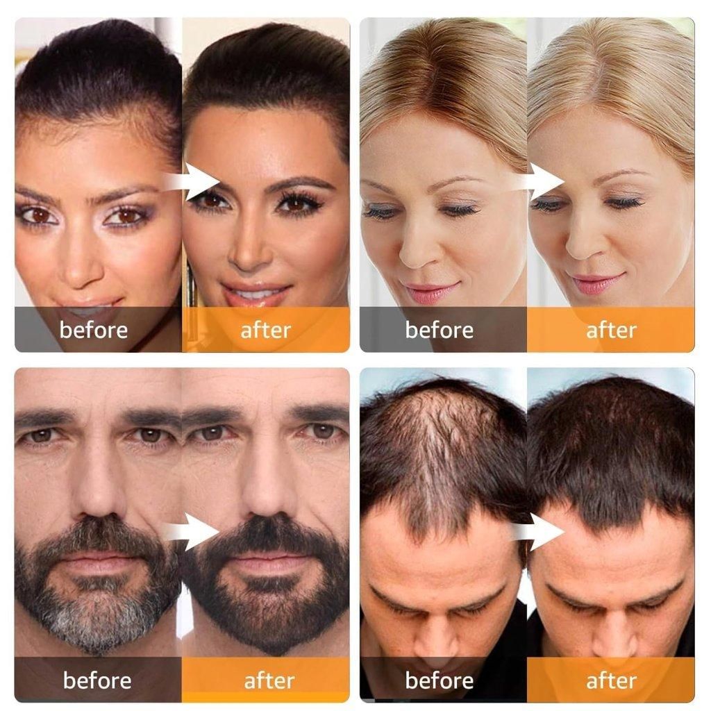 Before and after results showing the effectiveness of portable hairline black powder for fuller hair
