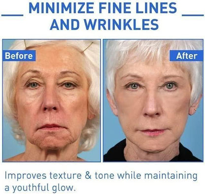 Before and after comparison showing the effectiveness of Botox anti-aging serum for reducing fine lines