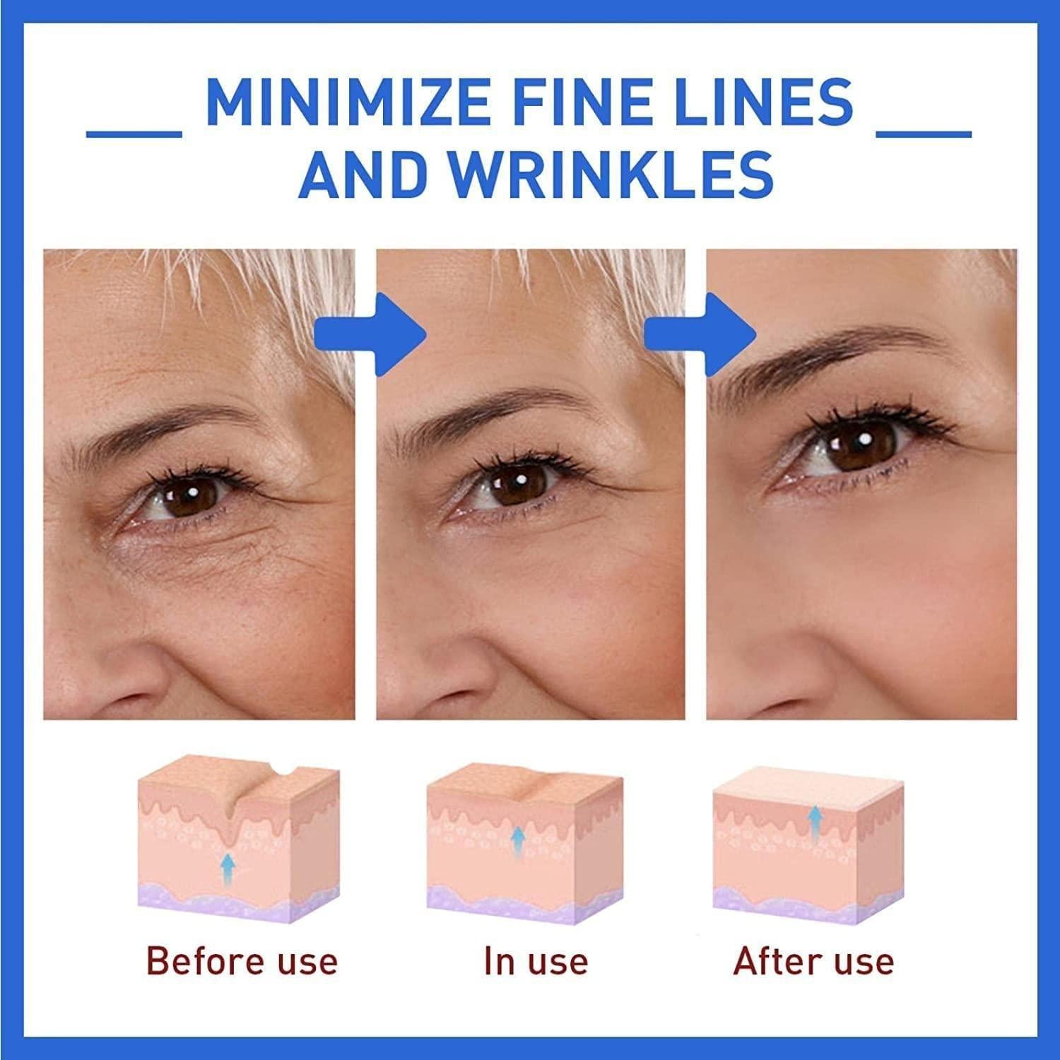 Botox anti-aging serum visual guide showing effects on fine lines and wrinkles before and after use