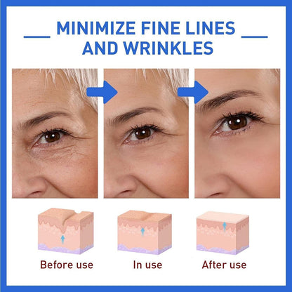 Botox anti-aging serum visual guide showing effects on fine lines and wrinkles before and after use